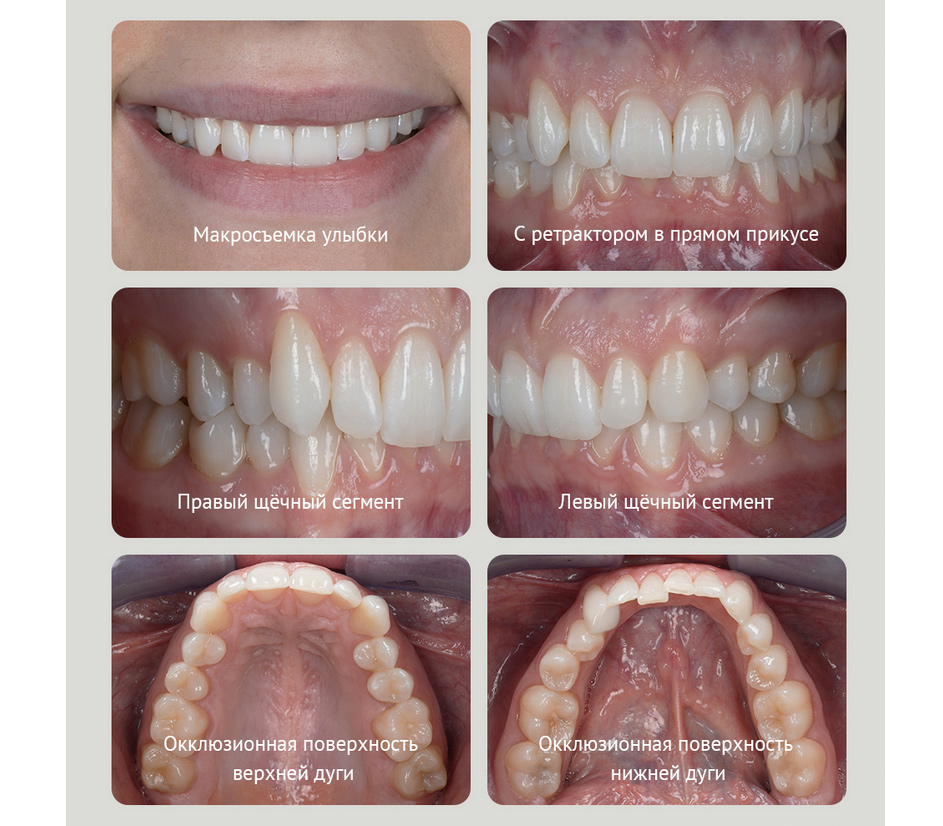 Макровспышка Godox MF12-DK1 для дентальной фотографии, для Sony